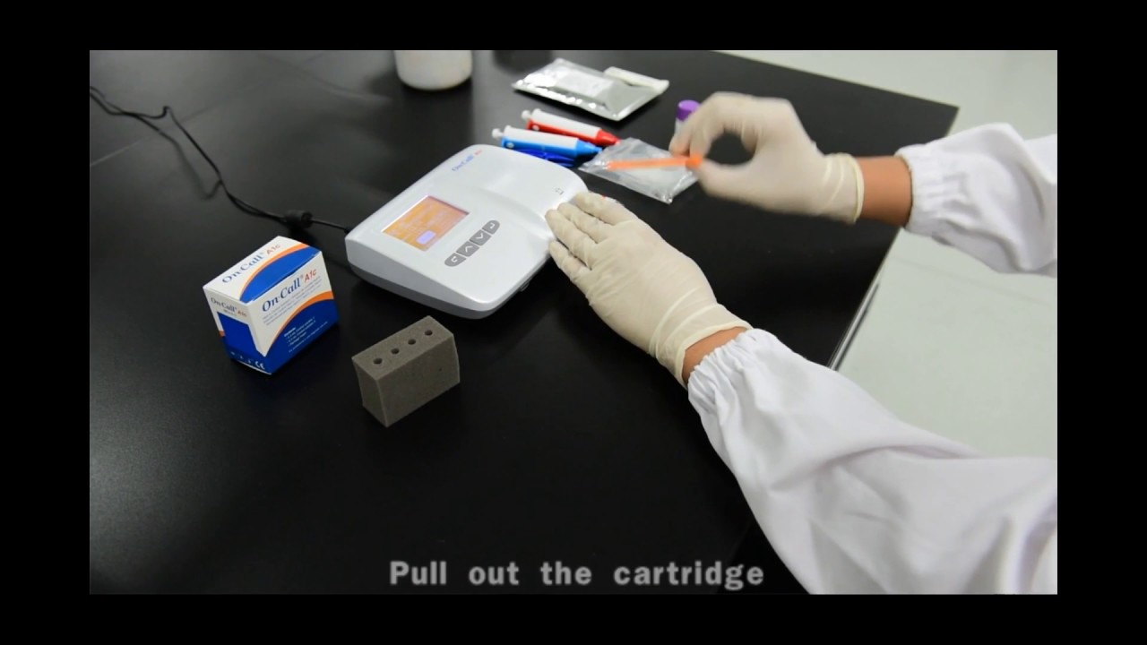 On Call A1c HbA1c Analysis System