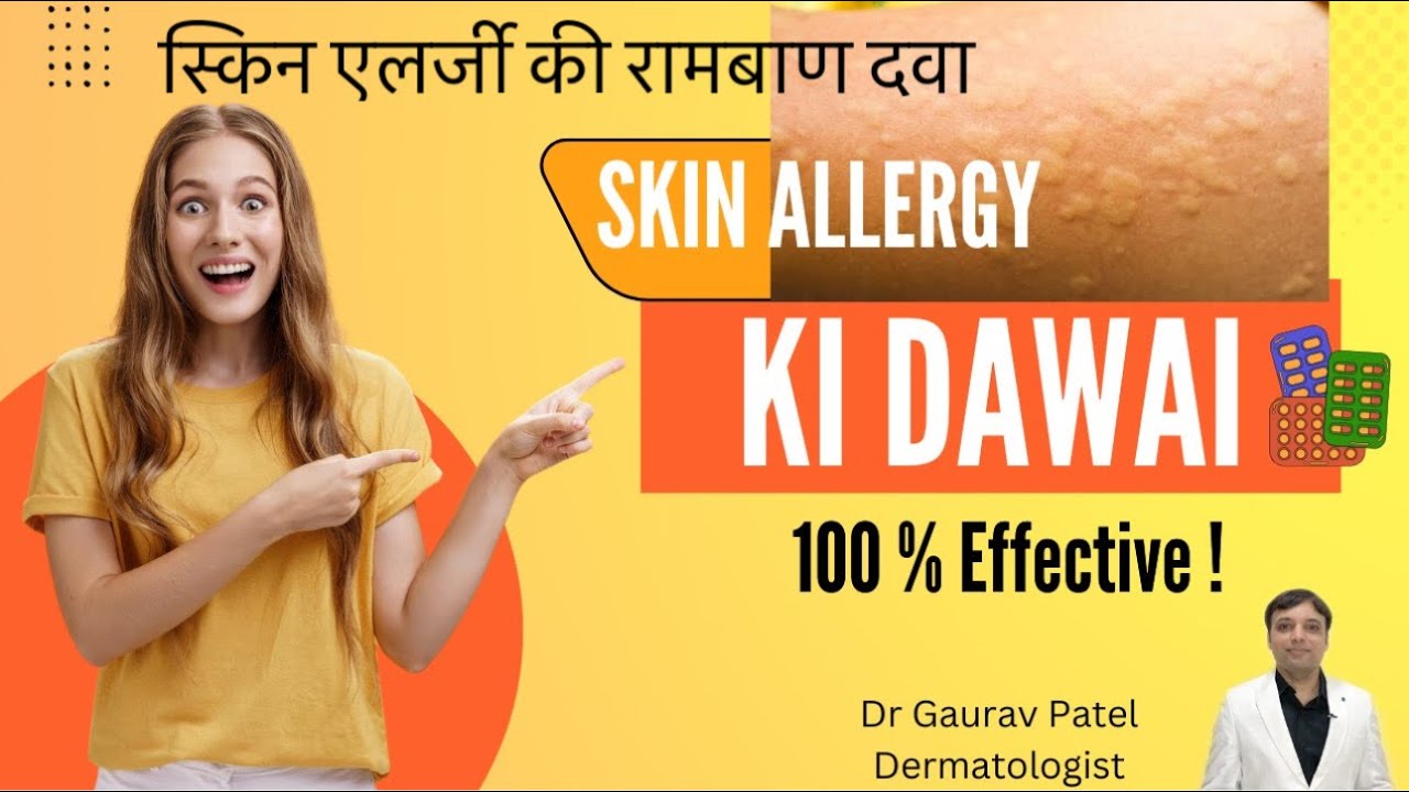 Skin allergy treatment | स्किन ऐलर्जी की दवाई| skin allergy ki dawa| Allergy ka ilaj at home