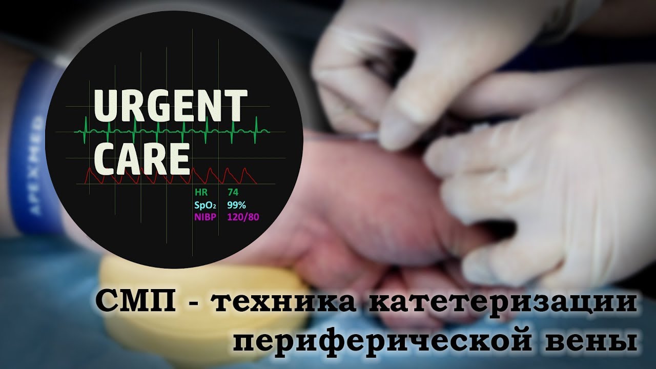 СМП - Техника катетеризации периферической вены