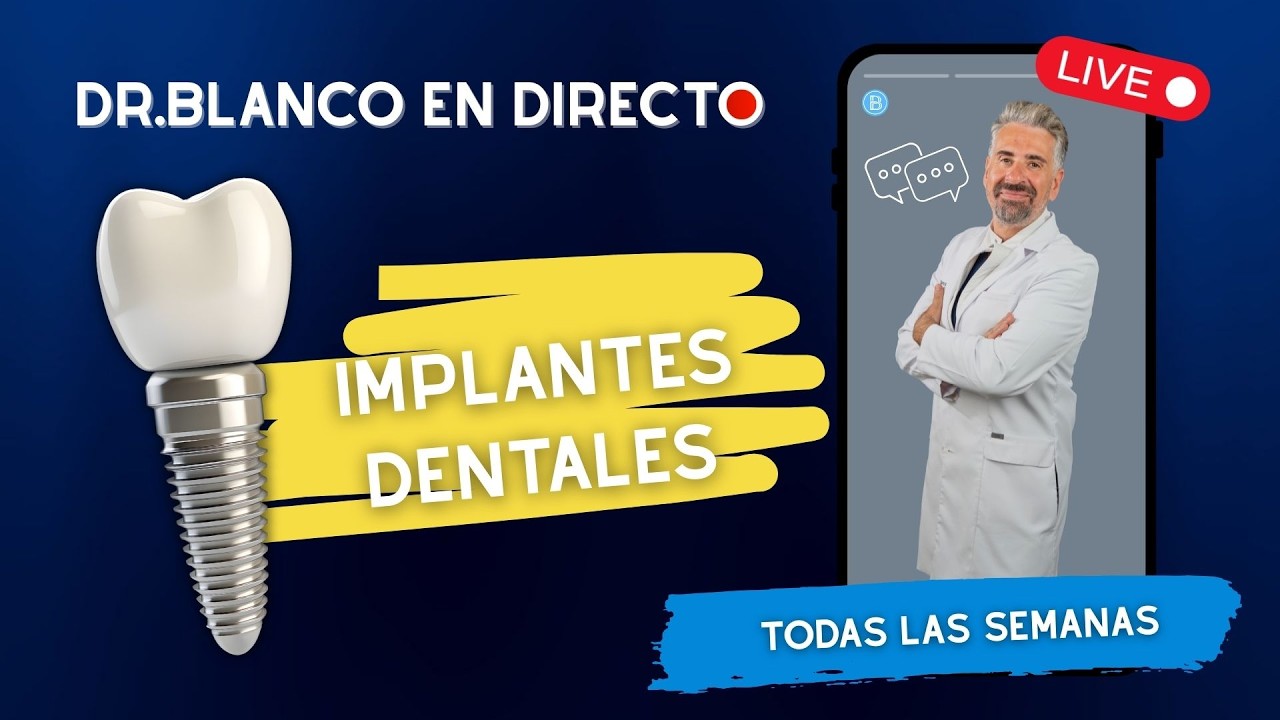 Implantes Dentales: Todo lo que debes saber (Materiales y Diferencias) | EN VIVO