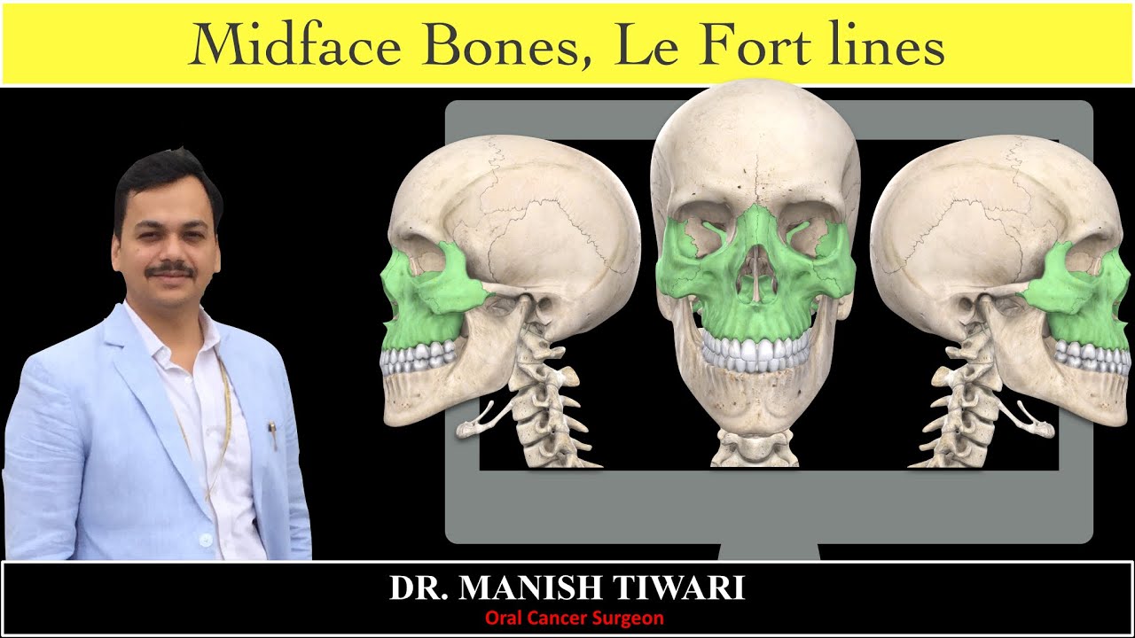 Le fort III fracture line | #StayHome and learn #WithMe