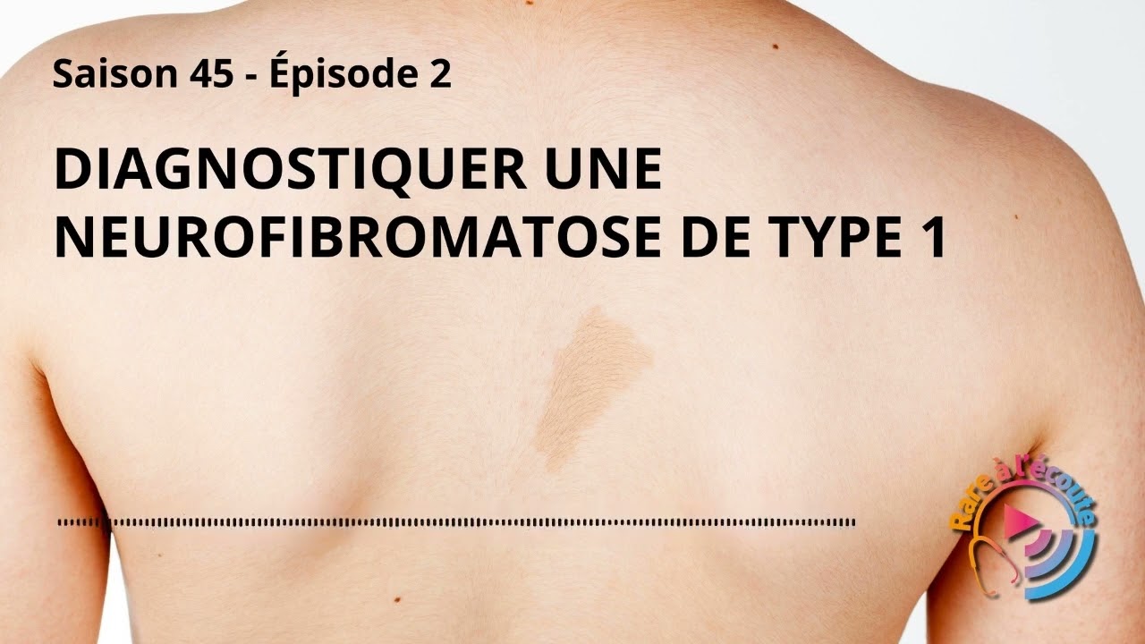 Maladie rare - Diagnostiquer une Neurofibromatose de type 1