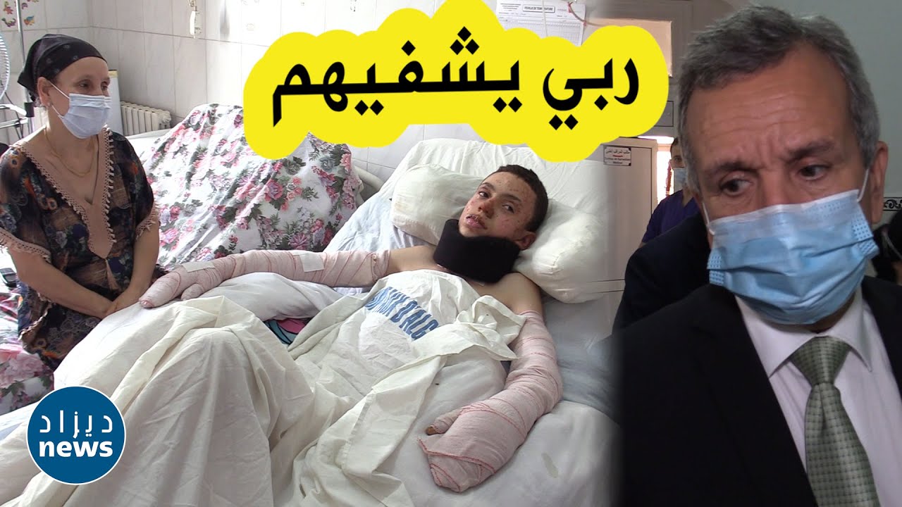 وزير الصحة يزور المصابين الأطفال في حرائق تيزي وزو بالمؤسسة المتخصصة في الحروق بالجزائر العاصمة