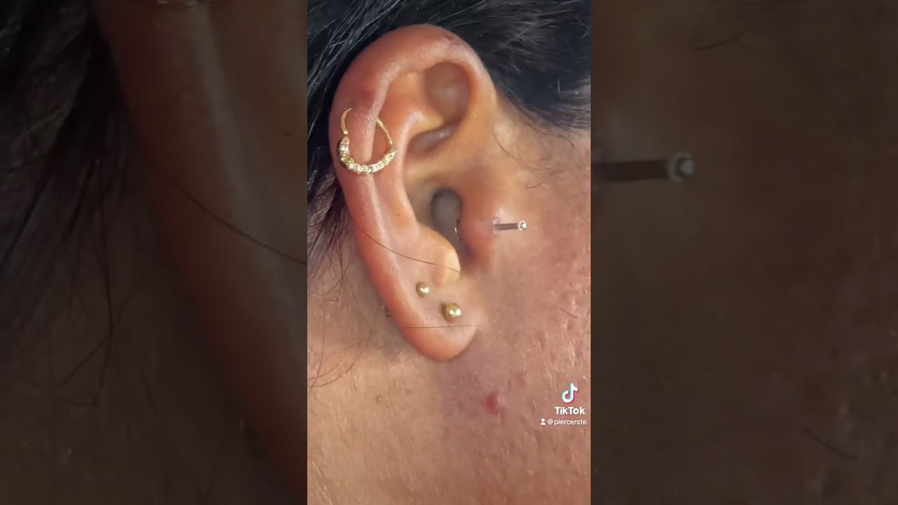 Remoção de piercing GIGANTE PARTE II #piercing #bodypiercing #ste