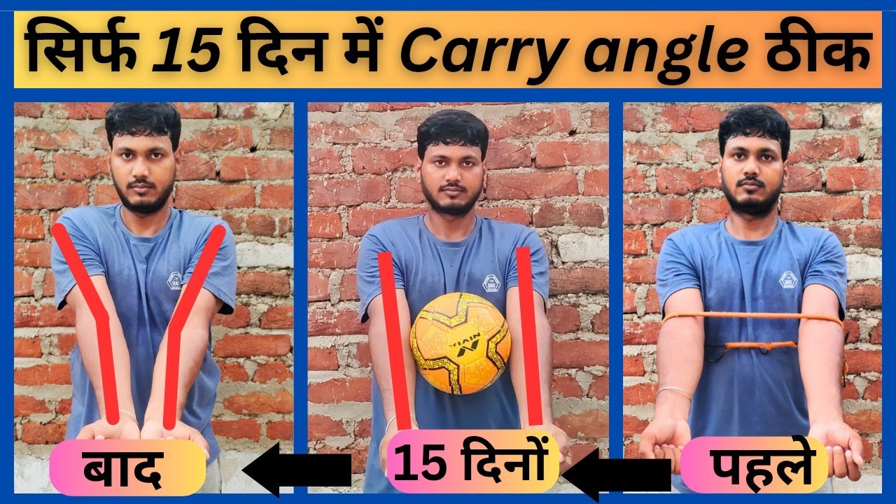 Best exercise for Carry angle|| carry angle kise thk kare|