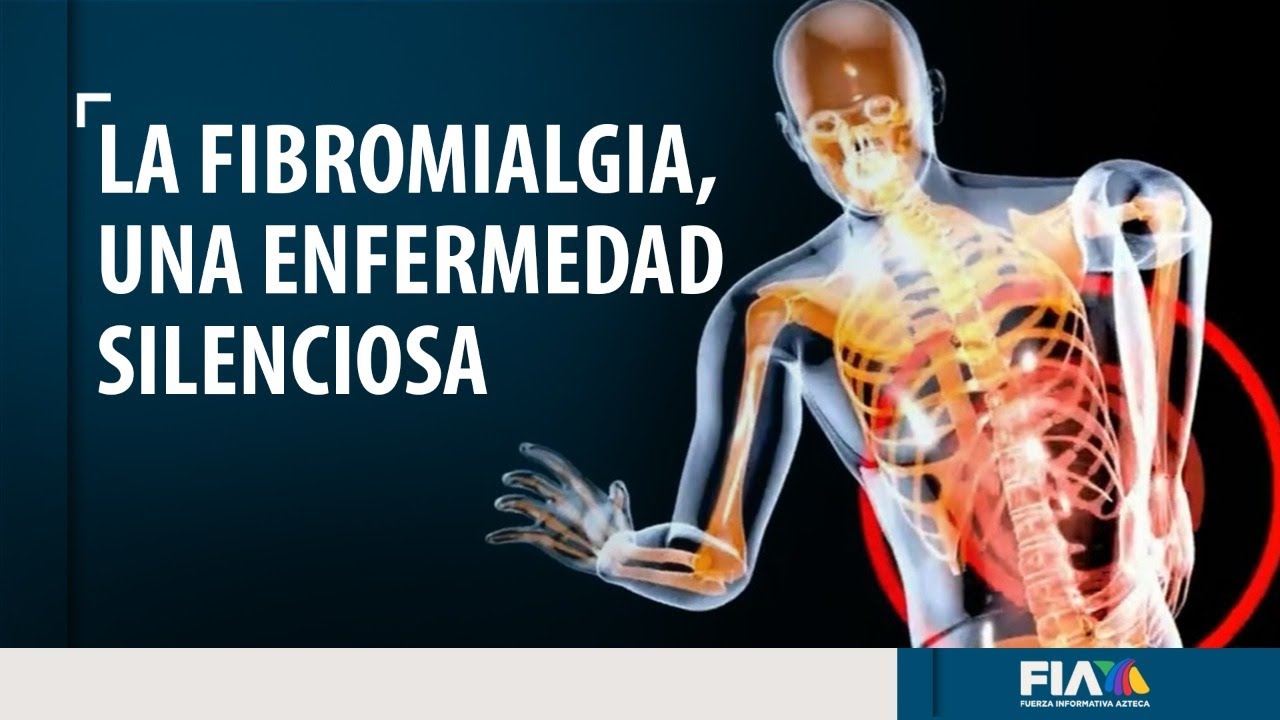&iquest;Dolores musculares? Podr&iacute;a ser fibromialgia, una enfermedad silenciosa