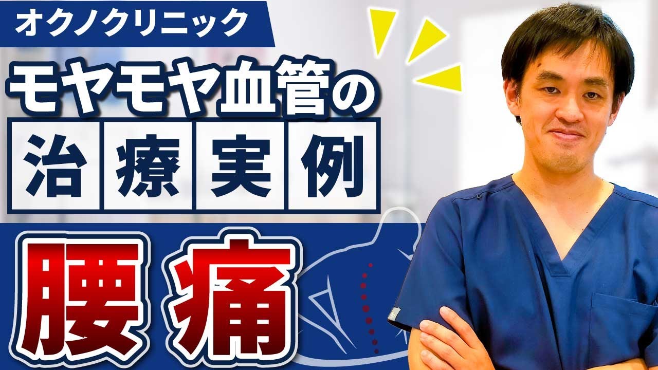 [治療実例]　モヤモヤ血管治療実例 腰痛