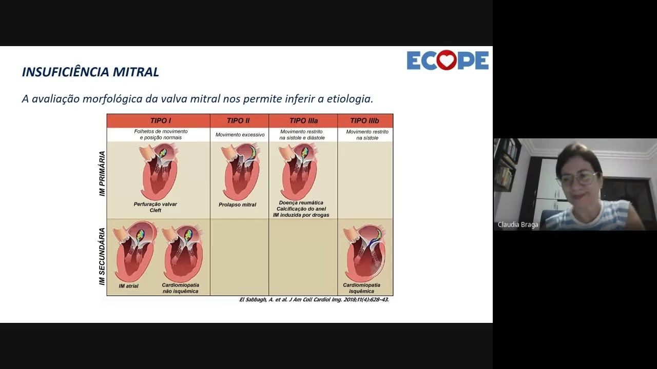 Live - Insuficiência Mitral