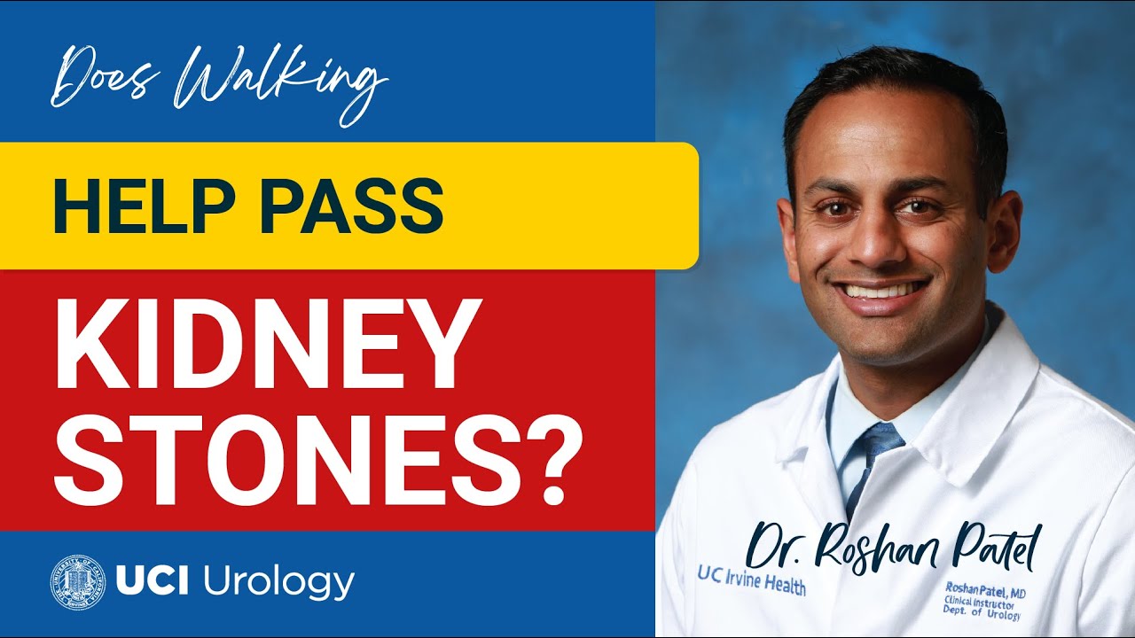 Does Walking Help Pass Kidney Stones? by Dr. Roshan Patel - UCI Department of Urology