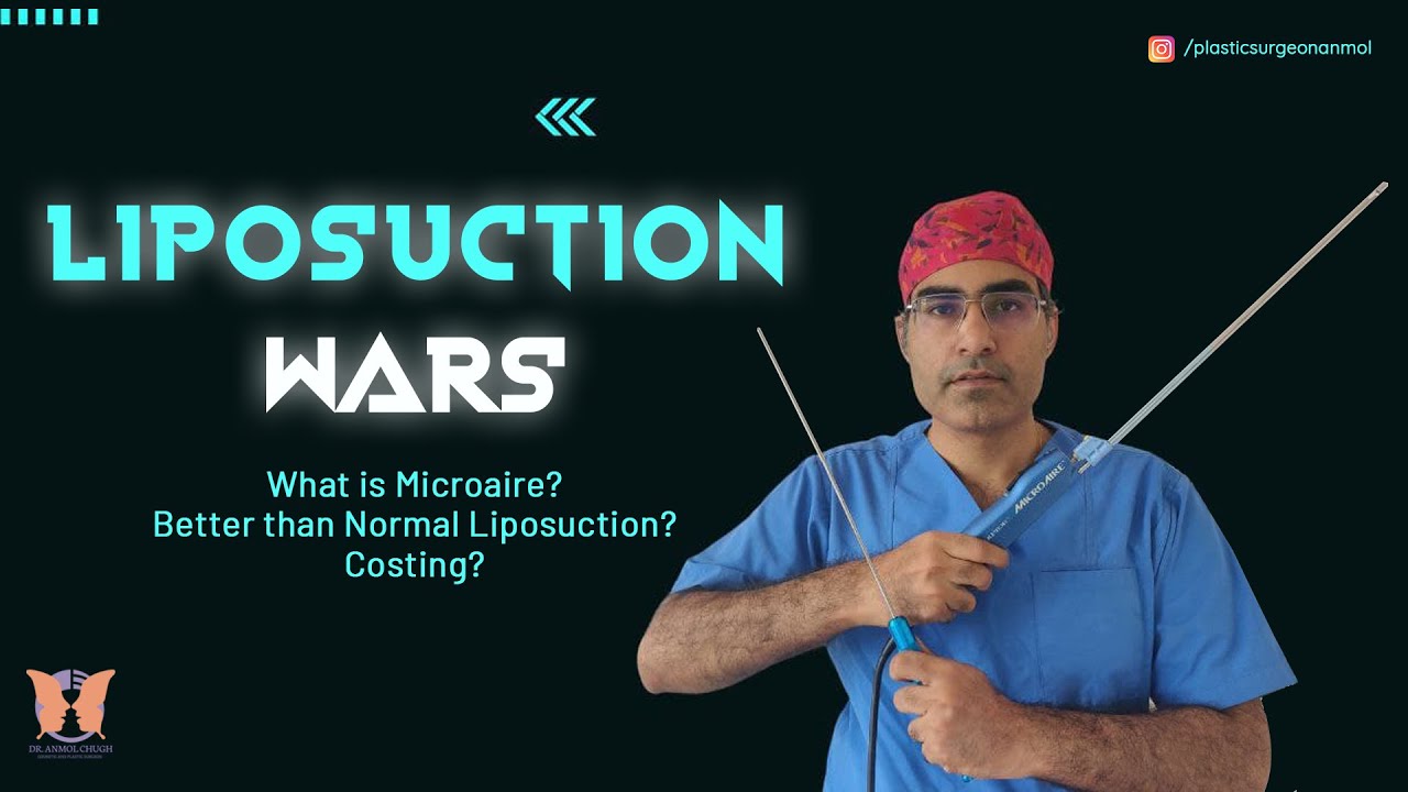 💥BANG💥💥| Microaire vs Power Assisted Liposuction Which is the BEST for Fat Removal?