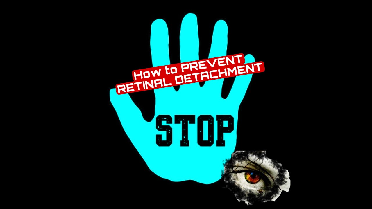 6: How to prevent Retinal Detachment/ RETINAL DETACHMENT/#retinaldetachment