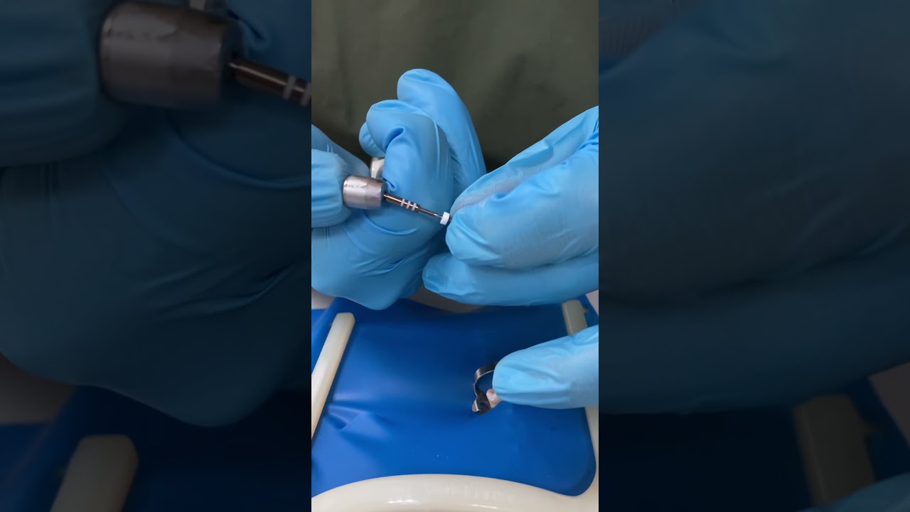 Protaper retratamiento