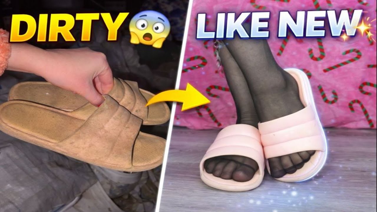I Cleaned the Dirtiest Rubber Slippers… INSANE RESULT 🤯 DIRTY ➜ LIKE NEW 😱 #cleaning #dirtytoclean