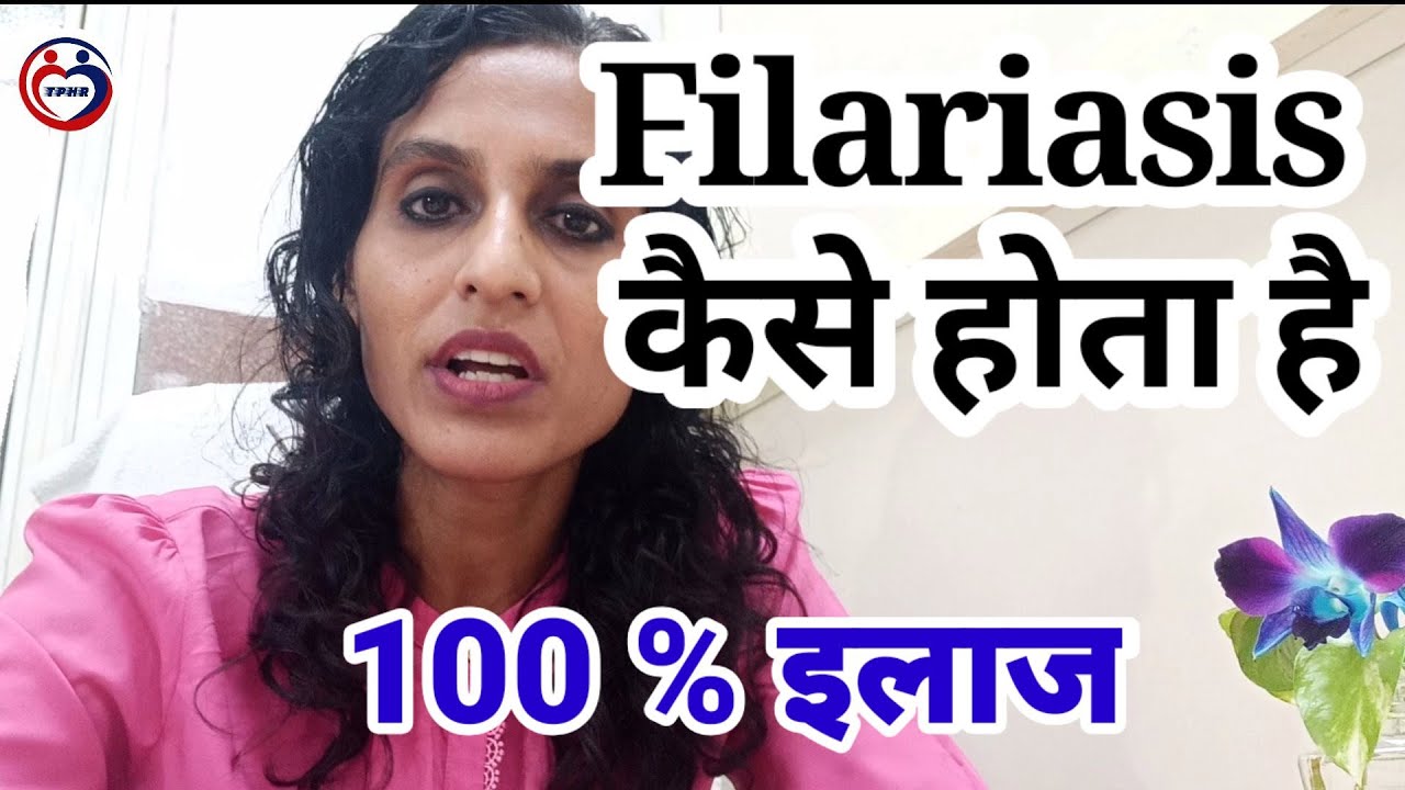 Filariasis | Elephantiasis cause, pathology and treatment