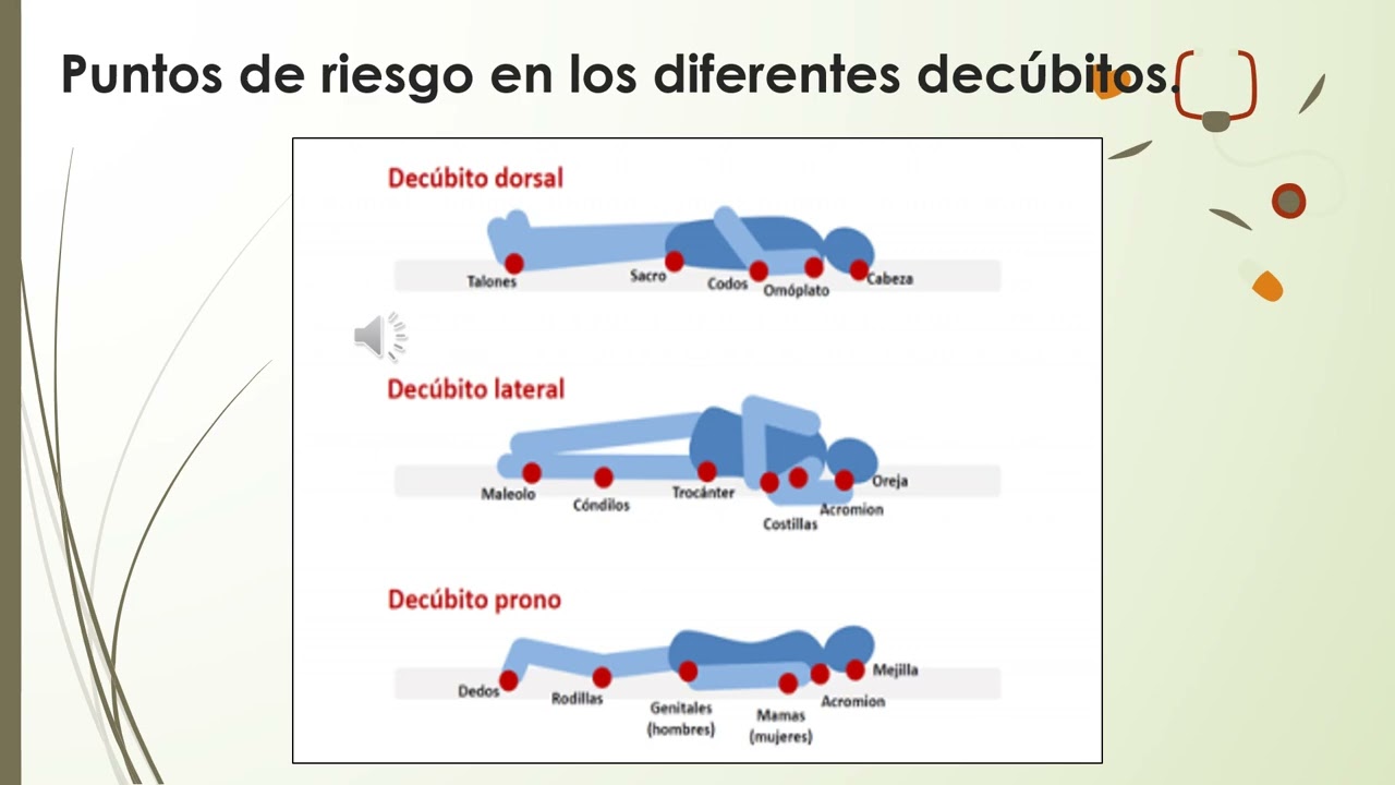 Lesiones Por Presión COMPARTIDO