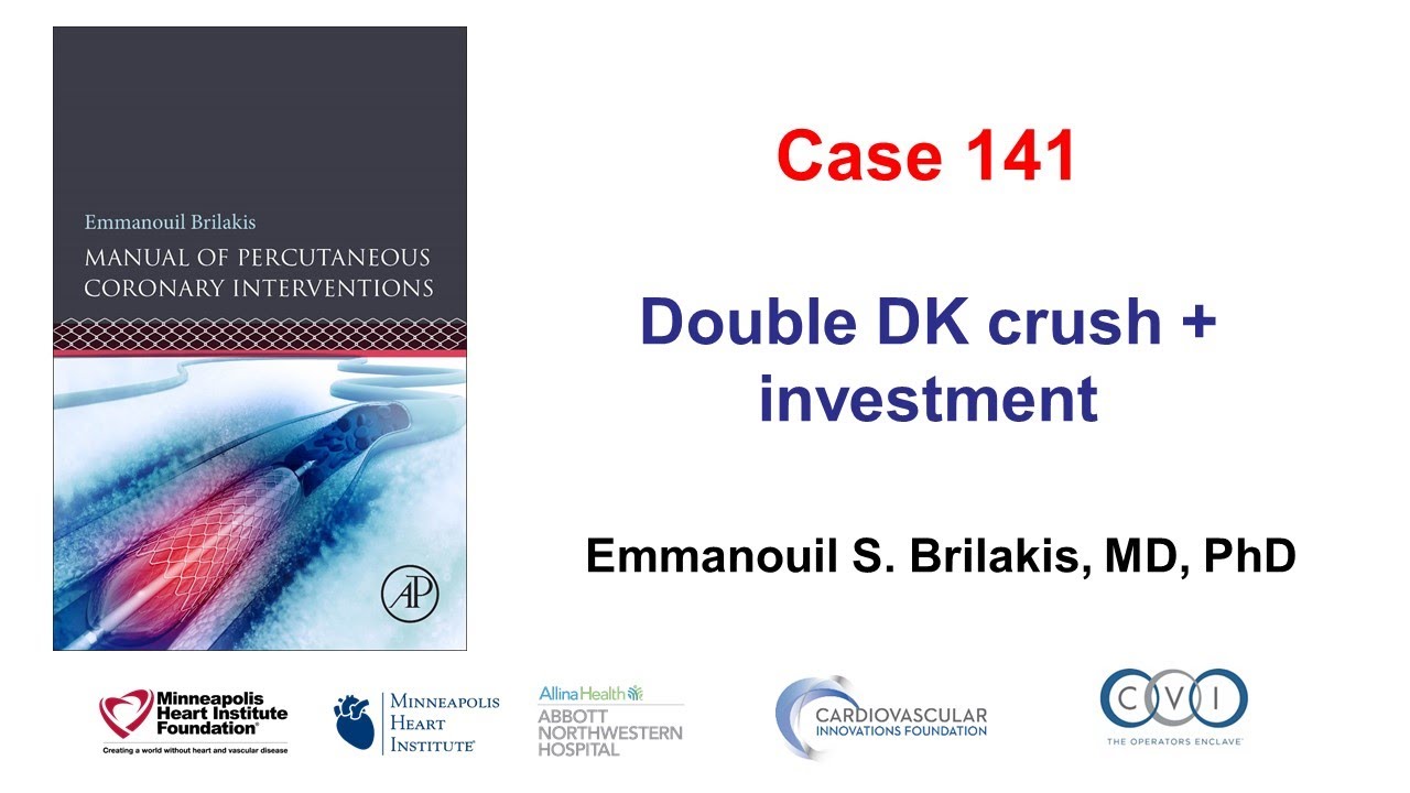 Case 141: PCI Manual - Double DK crush and investment