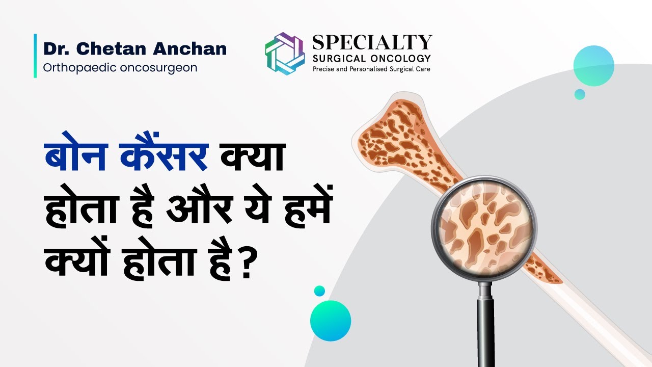 बोन कैंसर क्या होता है और ये हमें क्यों होता है? | Causes of Bone Cancer | Dr Chetan Anchan, SSO