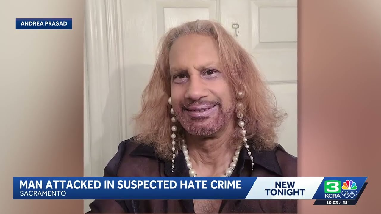 'Permanent brain damage': Man arrested in Midtown Sacramento hate crime attack, police say