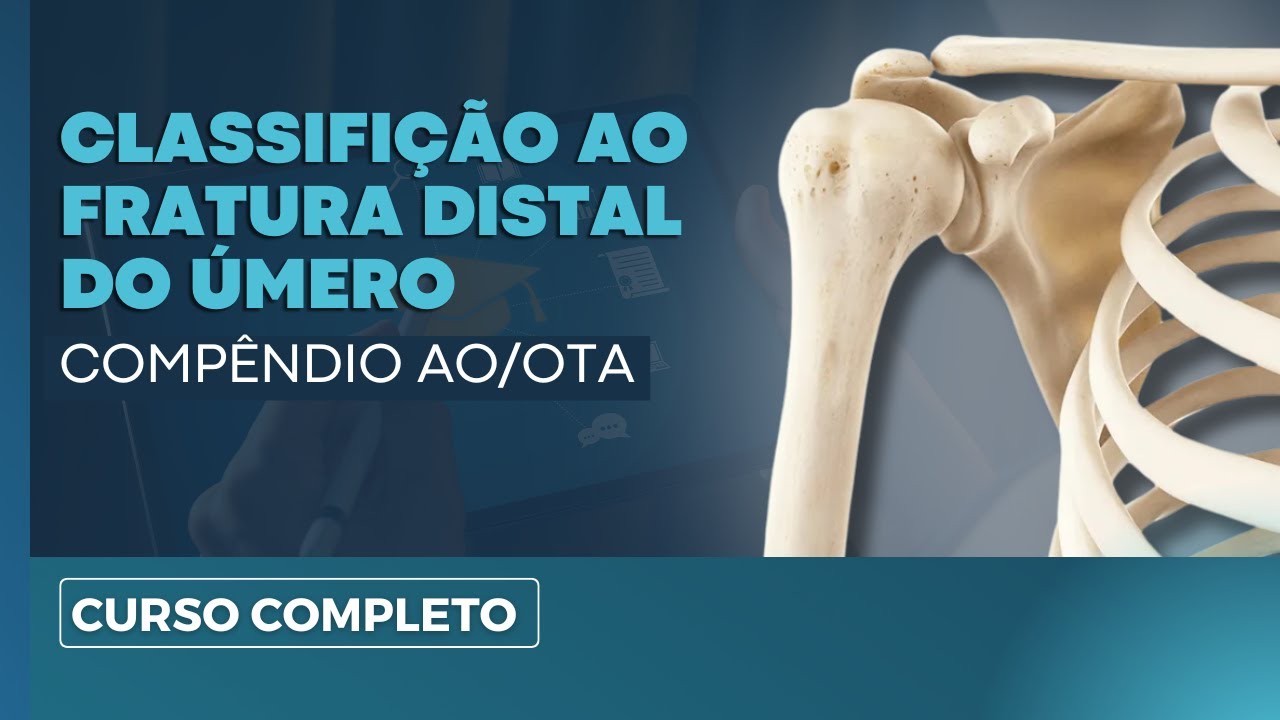 CLASSIFICAÇÃO AO PARA FRATURA DISTAL DO ÚMERO  | Dr. Marcelo D' Amado