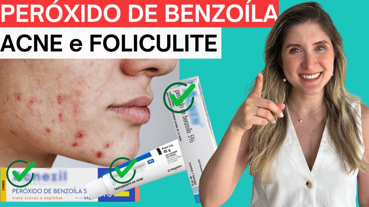 Peróxido de Benzoíla: Acnezil, Clindoxyl, Acnen, Dermotivin Benzac- Acne/Foliculite [Pela Dermato]