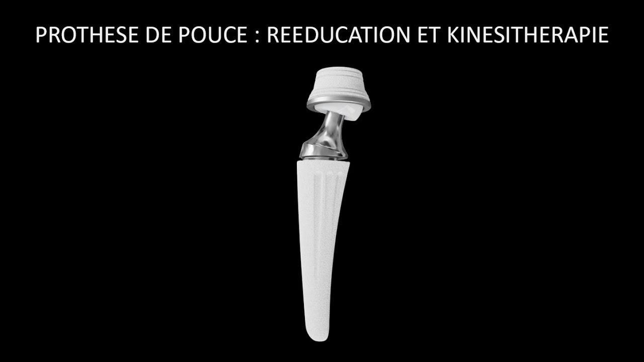 PROTHESE DE POUCE, REEDUCATION, KINESITHERAPIE