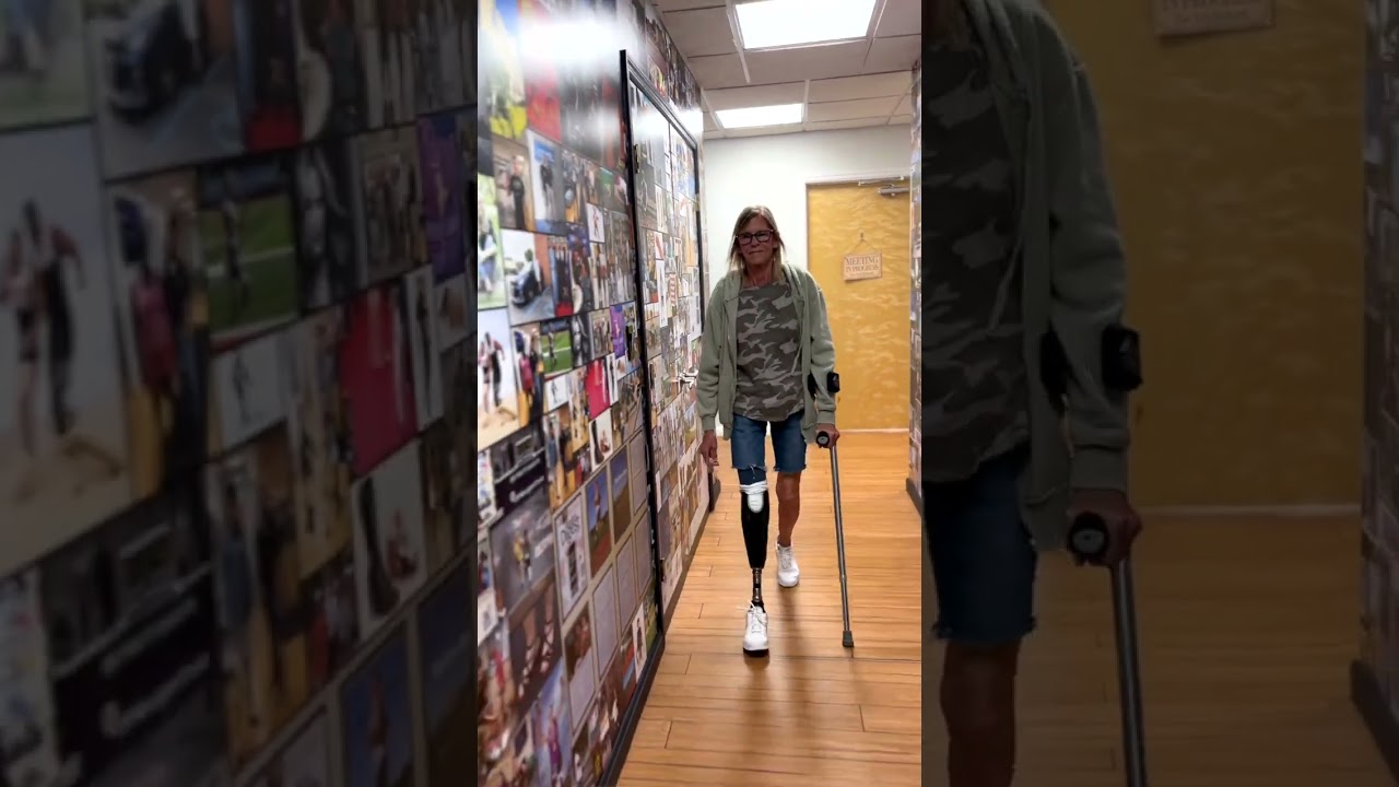 Christina a Below knee amputee, sharing her experience at A Step Ahead Prosthetics