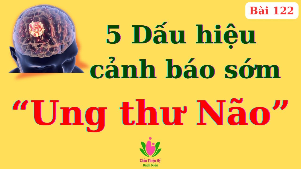 Ung Thư Não - 5 Dấu Hiệu Nhận Biết Sớm Rất Dễ Bị Nhầm Lẫn, Chủ Quan, Giải Đáp 7 Câu Hỏi Liên Quan