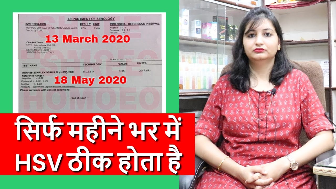 How to cure HSV with Homeopathy | Successful HSV Treatment with Proof | Herpes Ka Ilaj with Report
