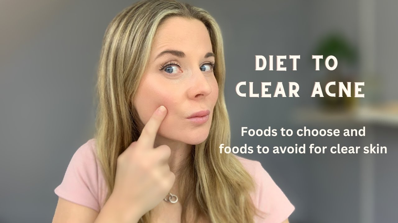 Diet to clear acne- which foods to add and which to avoid for clear skin