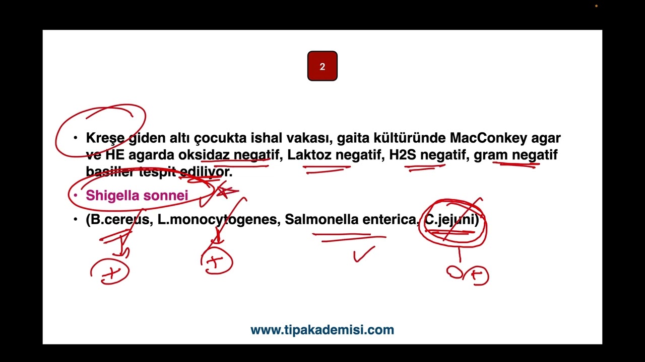 FA MİKROBİYOLOJİ TUS 2025 AĞUSTOS DEĞERLENDİRME