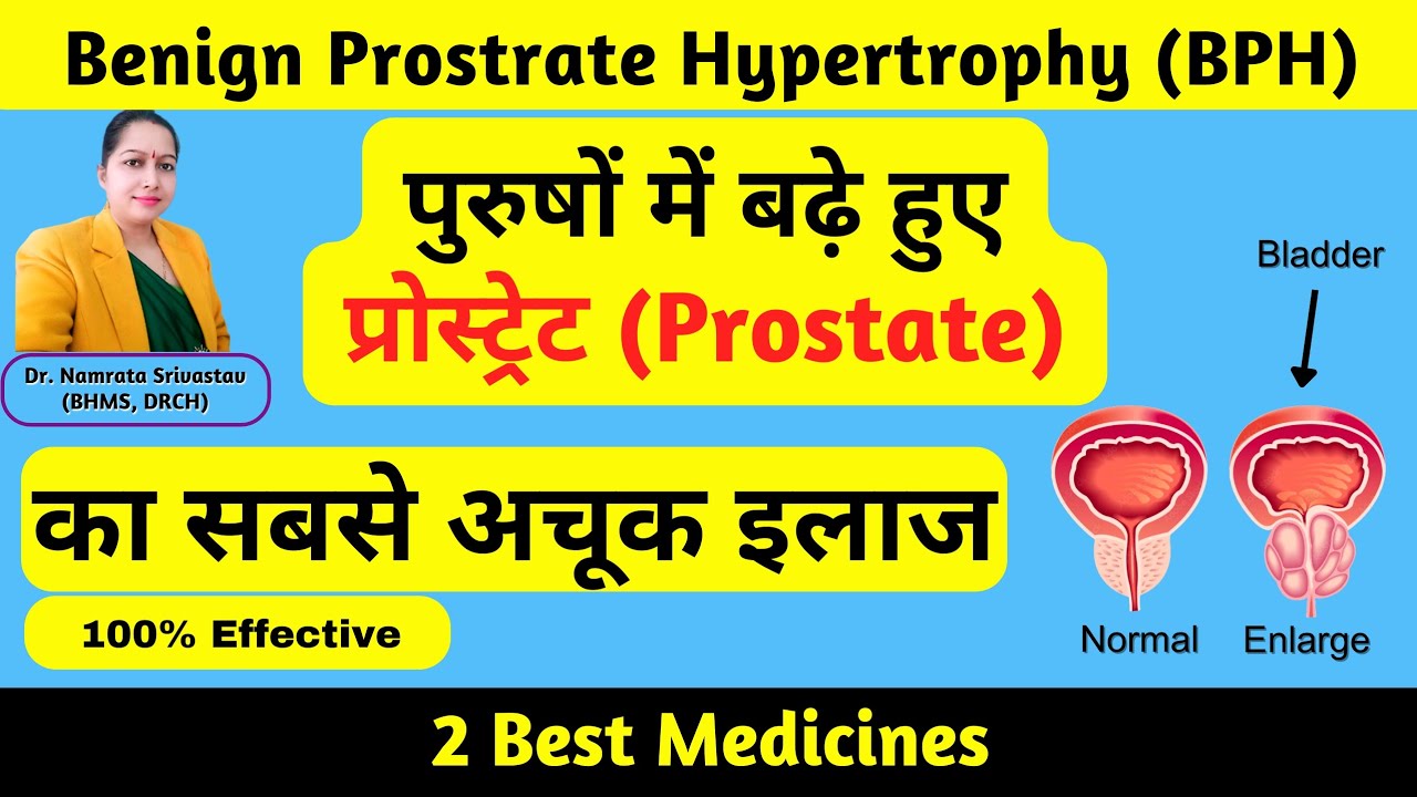 Benign Prostrate Hypertrophy/बिना सर्जरी,बढ़े हुए प्रोस्टेट का जड़ से इलाज#prostateproblems