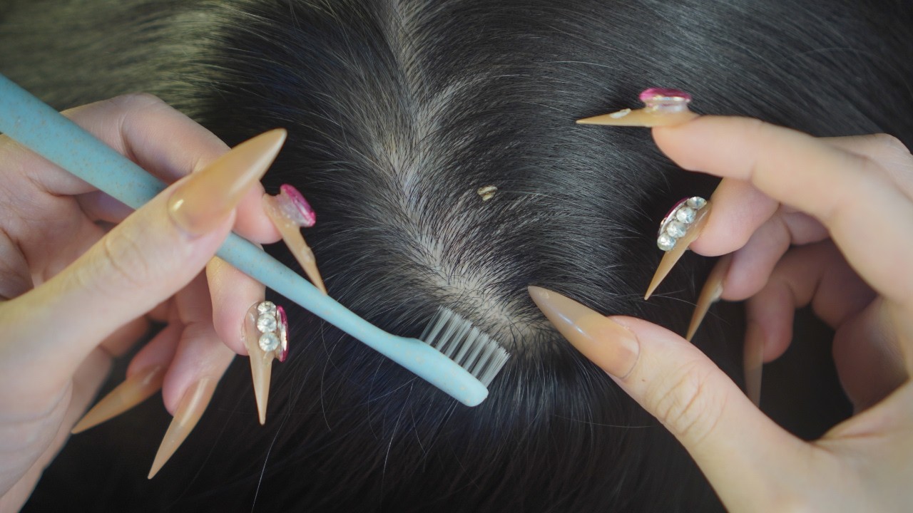 Scalp Check ASMR | Scalp Scratching & Soft Brushing With Toothbrush For Sleep Aid ( No Whisper )