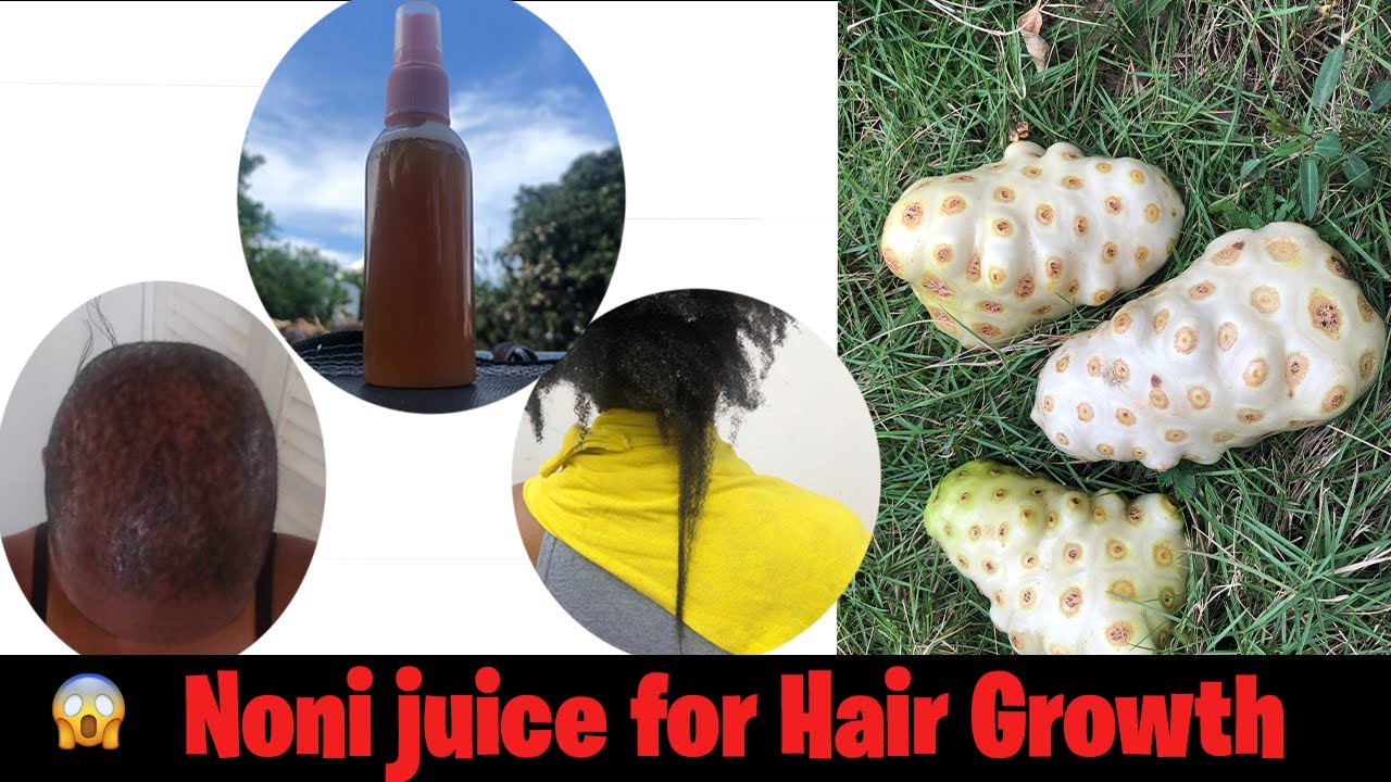 Thicken Thin Hair. Stop Hair Fall with Noni Juice