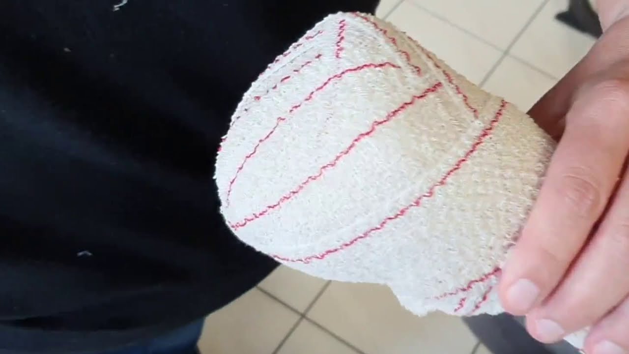 Verbandleer: stompverband (eerste wijze)