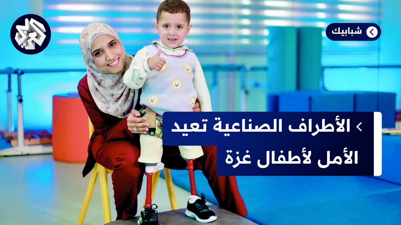 غزة.. أطفال يستفيدون من خدمة الأطراف الصناعية
