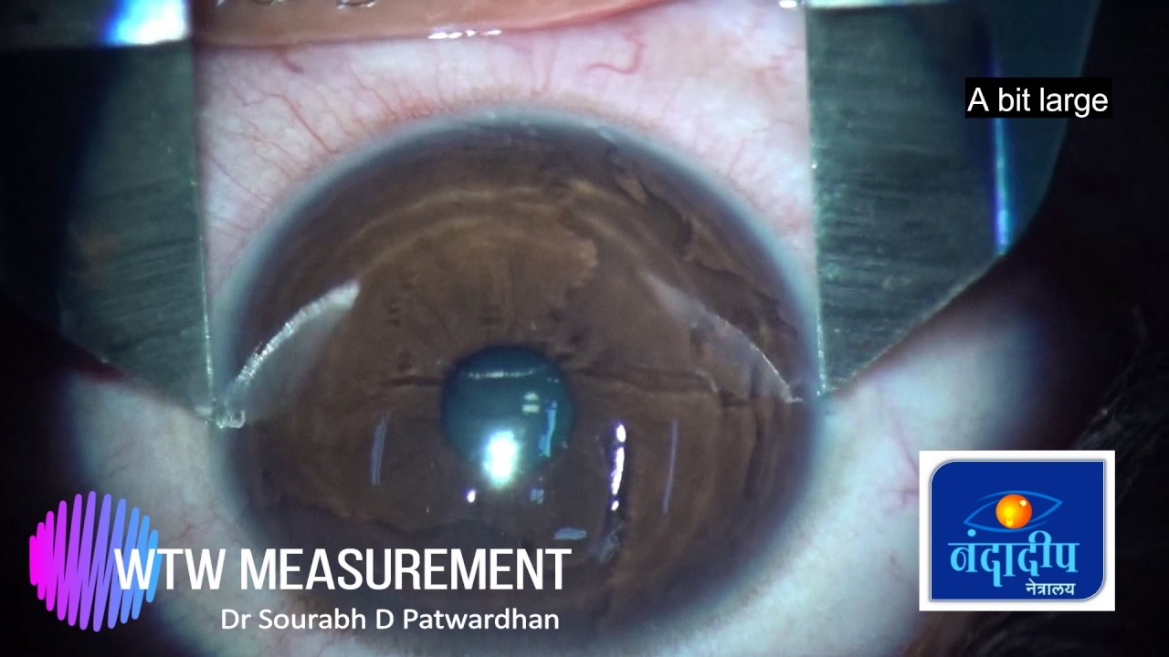 WTW measurement for IPCL