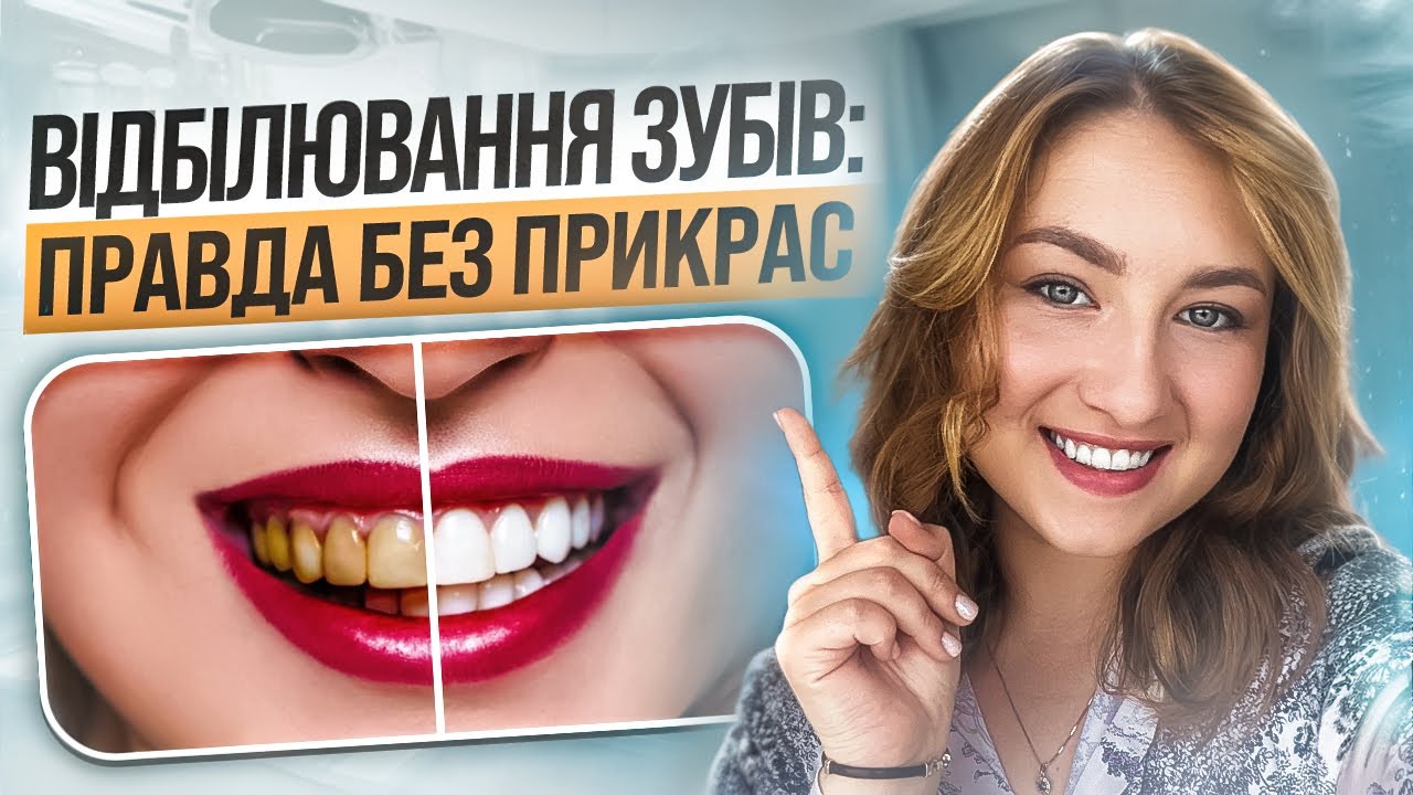 🇺🇦 Отбеливание зубов: правда, которую не расскажут в рекламе