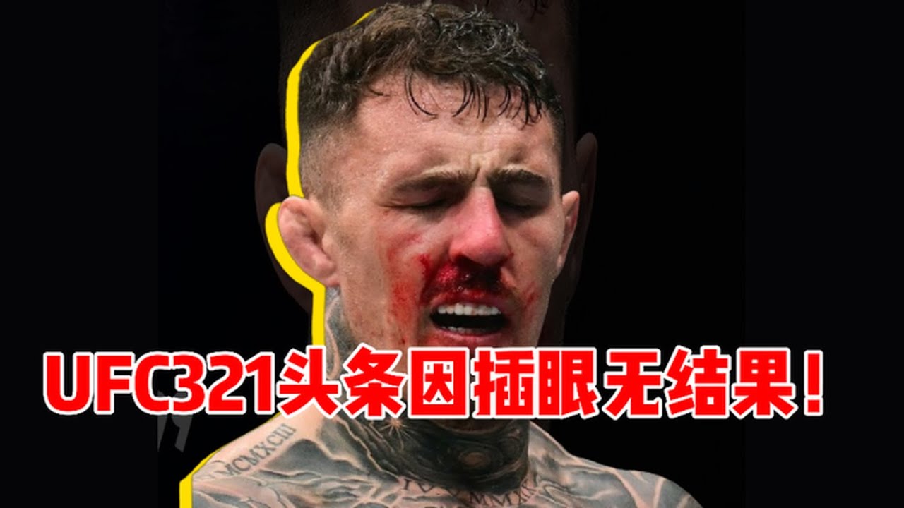 UFC321头条汤姆vs盖恩因插眼无结果！