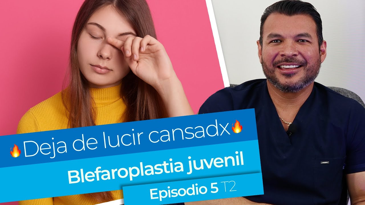 🔥 Deja de lucir cansadx a tus 26 🔥 La blefaroplastia juvenil es tendencia en cirugía plástica 🤩👏🏻🌟