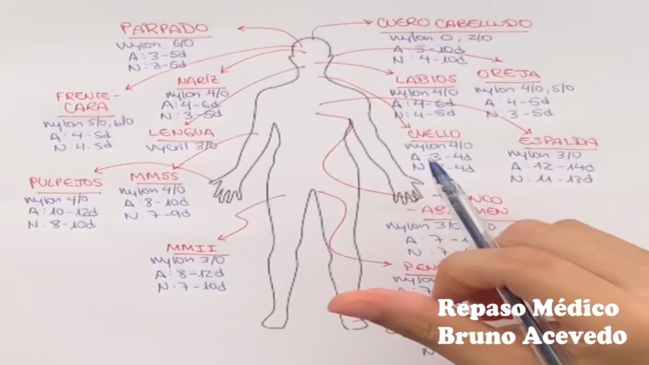 Elección de sutura y retiro de puntos