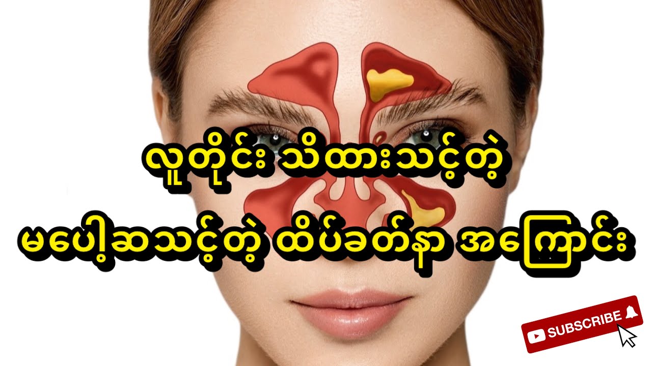 လူတိုင်းသိထားသင့်ပြီး မပေါ့ဆသင့်တဲ့ ထိပ်ခတ်နာ အကြောင်း