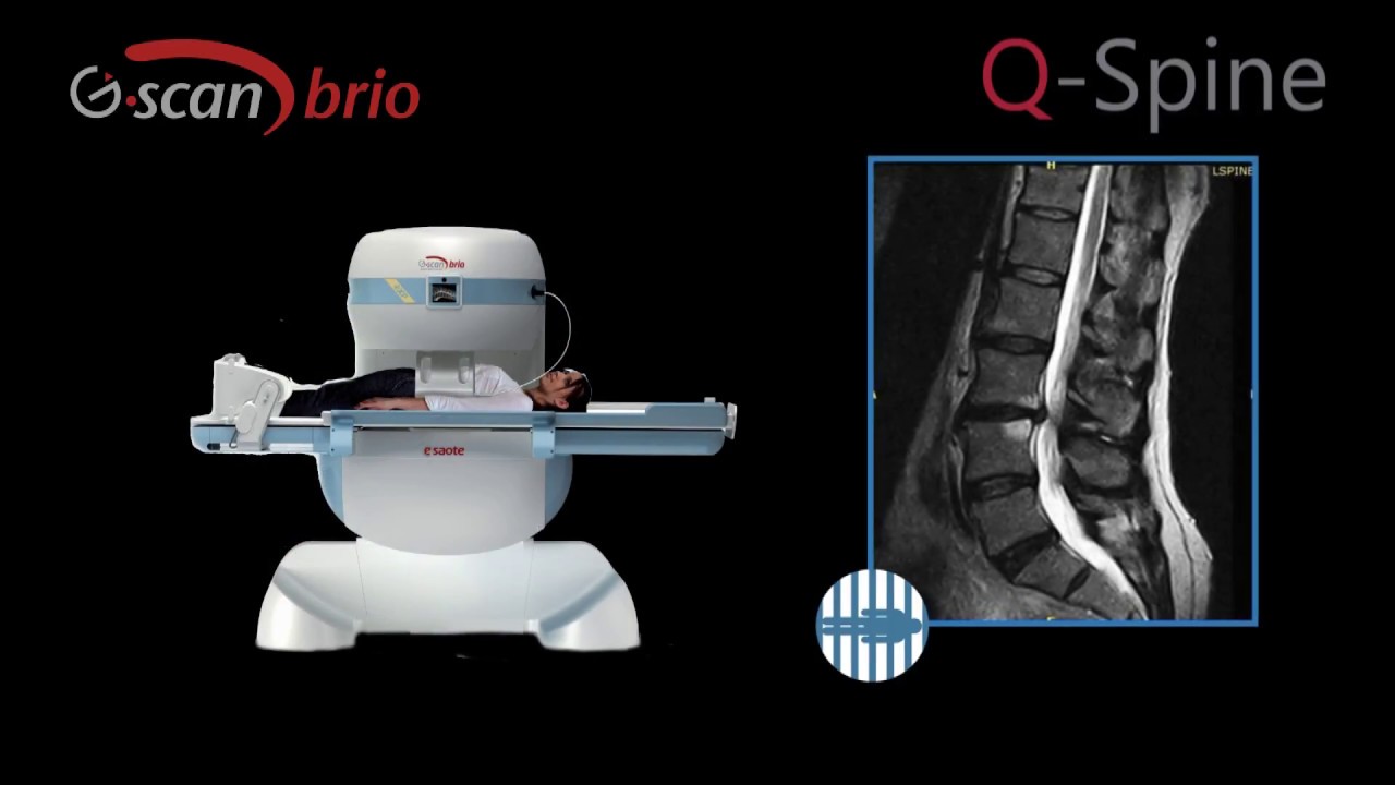 Q-Spine, the next step in MRI spine analysis