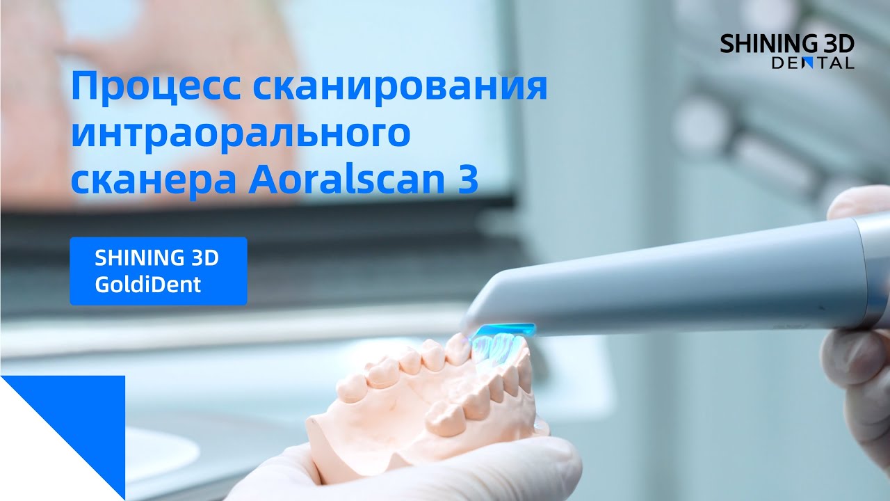 Процесс сканирования интраорального сканера Aoralscan 3 Shining 3D | репост GoldiDent