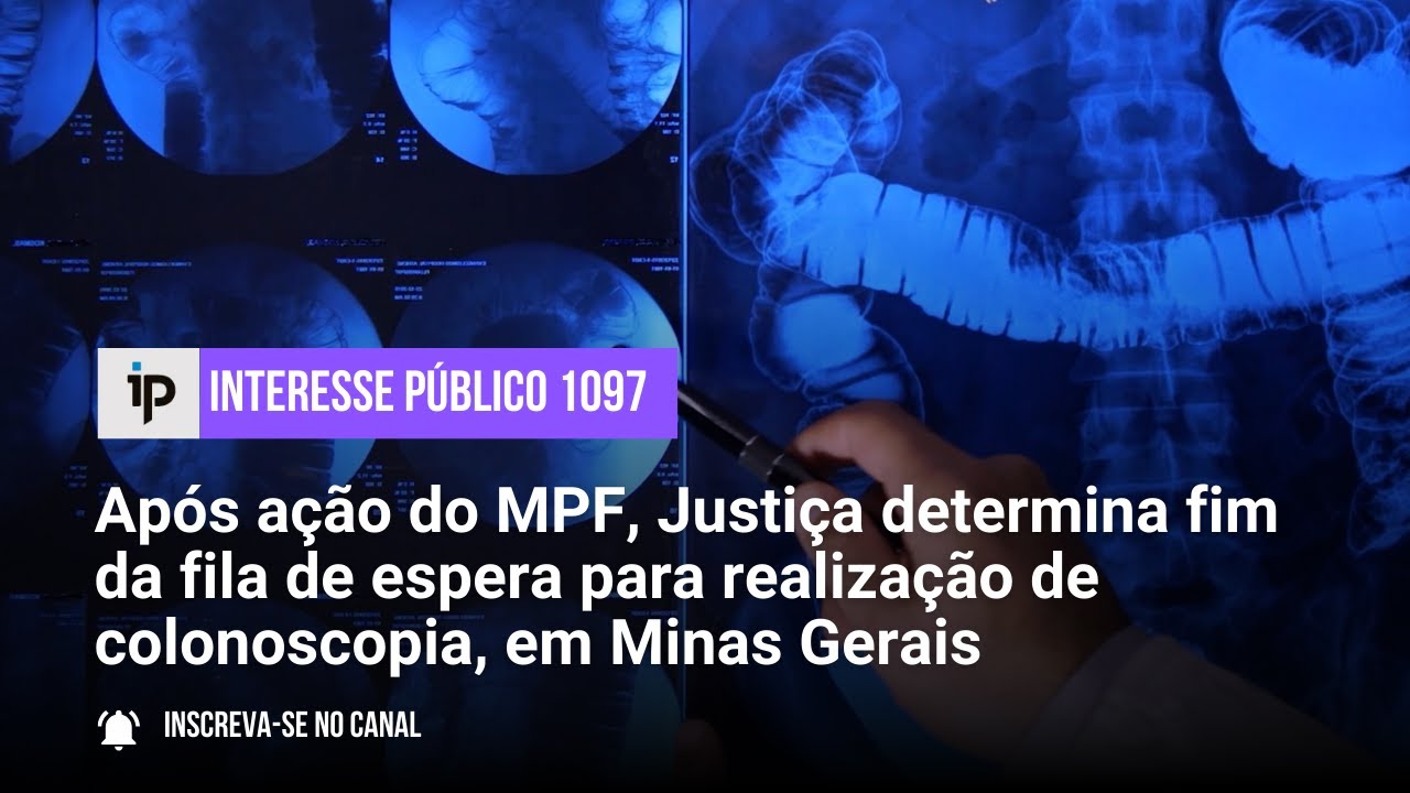 Após ação do MPF, Justiça determina fim da fila de espera para colonoscopia - IP 1097