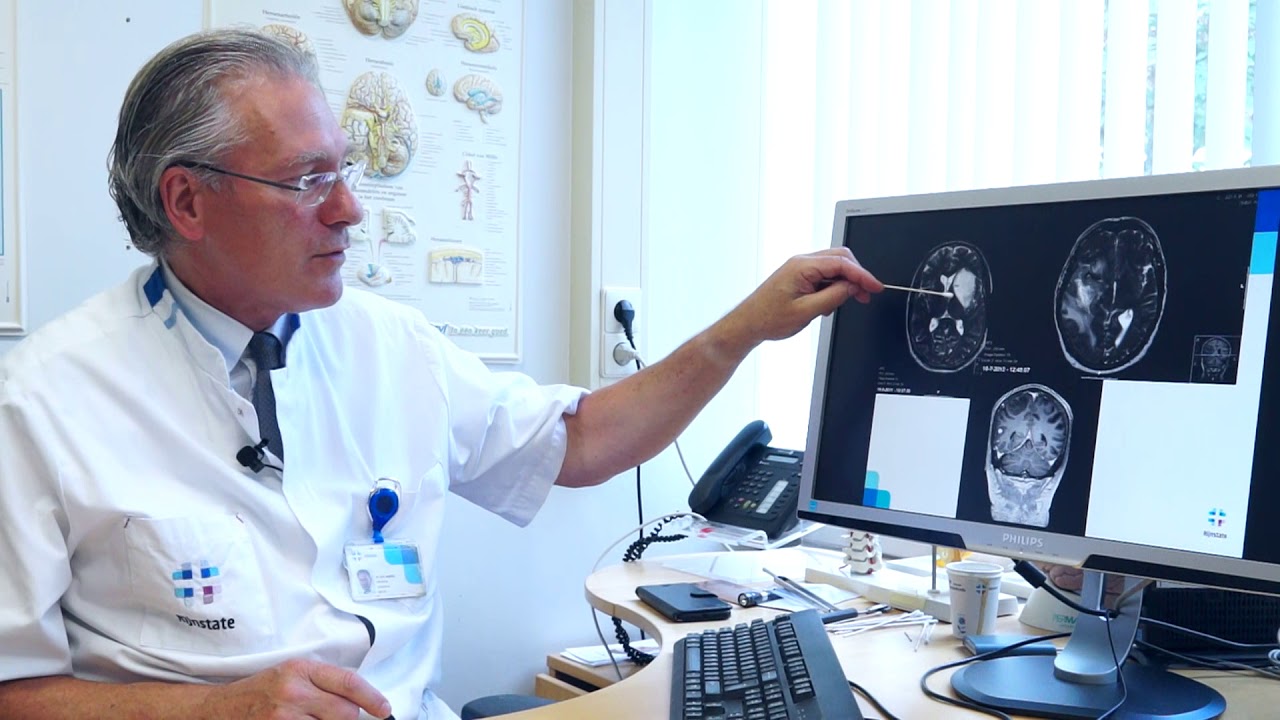 Neuroloog van Rijnstate vertelt over een hersentumor