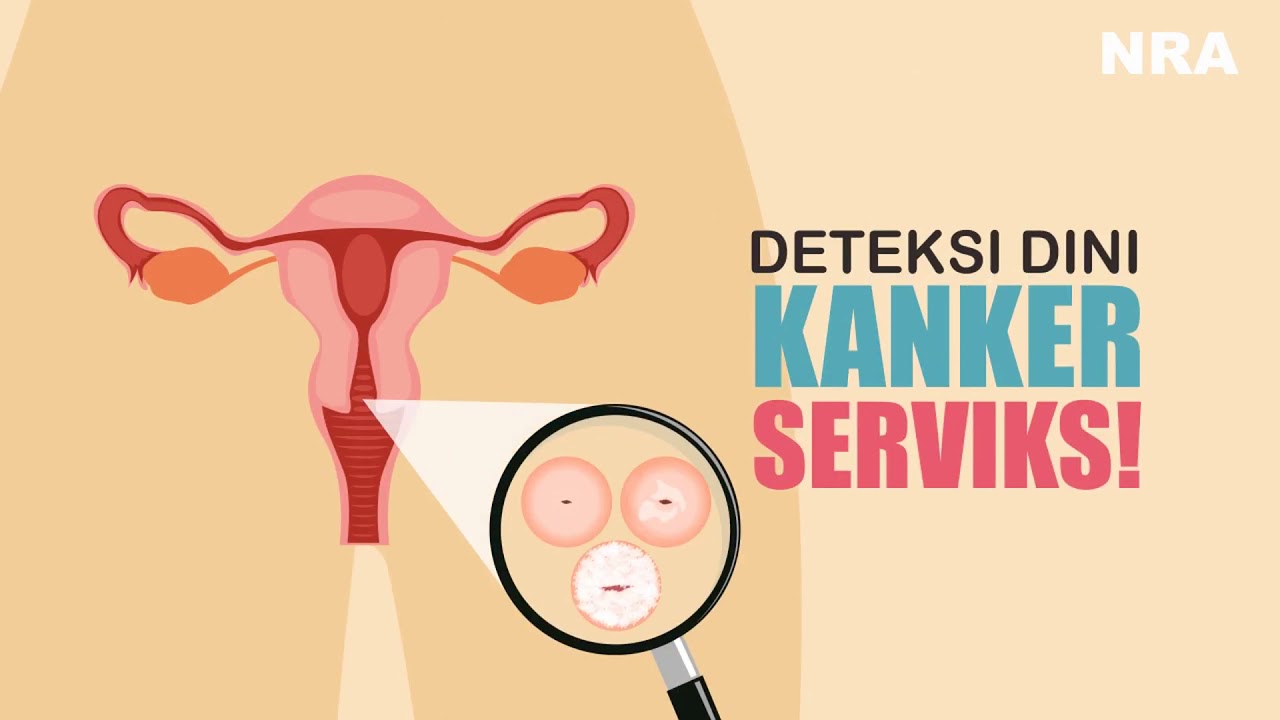 Video Promkes IVA Test