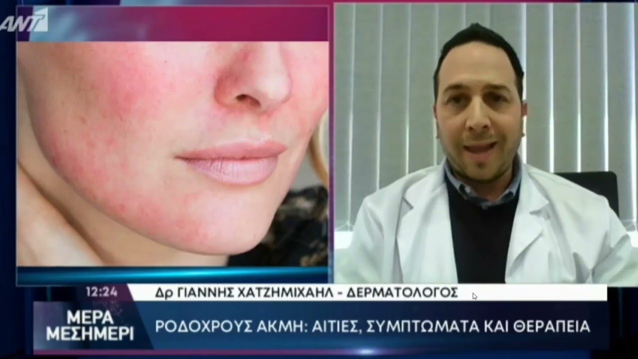 O Dr. med. Γιάννης Χατζημιχαήλ μιλά στην εκπομπή του ΑΝΤ1 Μέρα Μεσημέρι για την Ροδόχρου Ακμή.