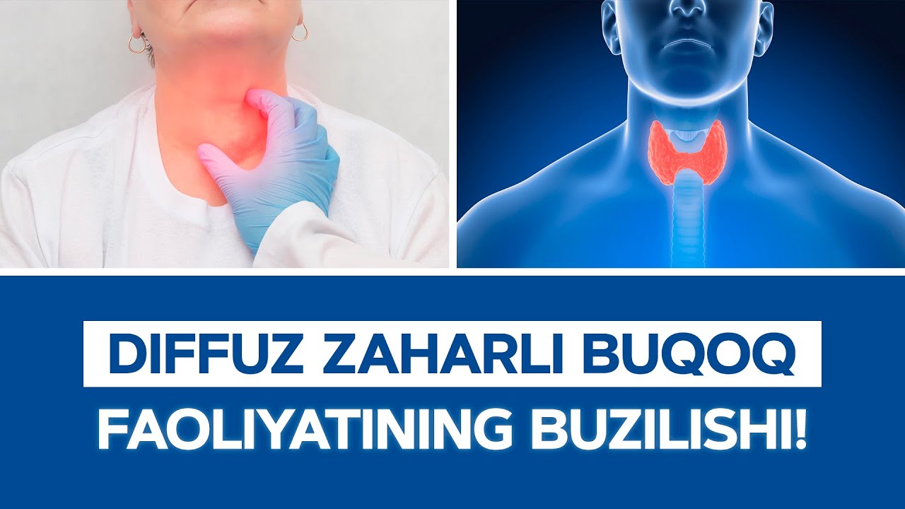DIFFUZ ZAHARLI BUQOQ FAOLIYATINING BUZILISHI! | AAKASH HEALTHCARE TASHKENT
