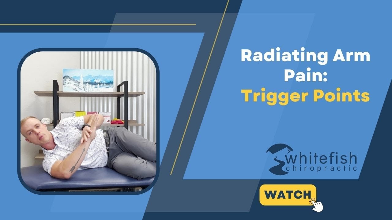 Radiating Arm Pain - Trigger Points