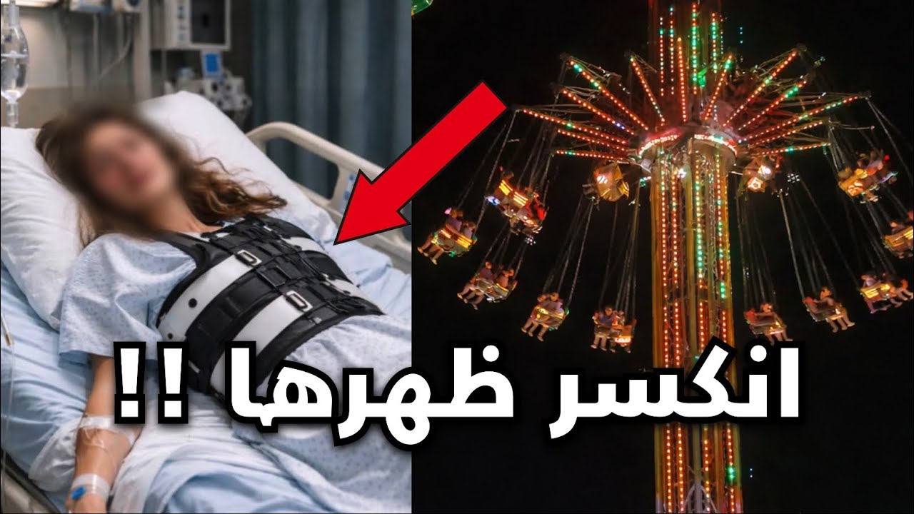 البنت هذي طاحت من اللعبه و انكسر ظهرها 🎡💔!! ( حادثة تبوك 😢)